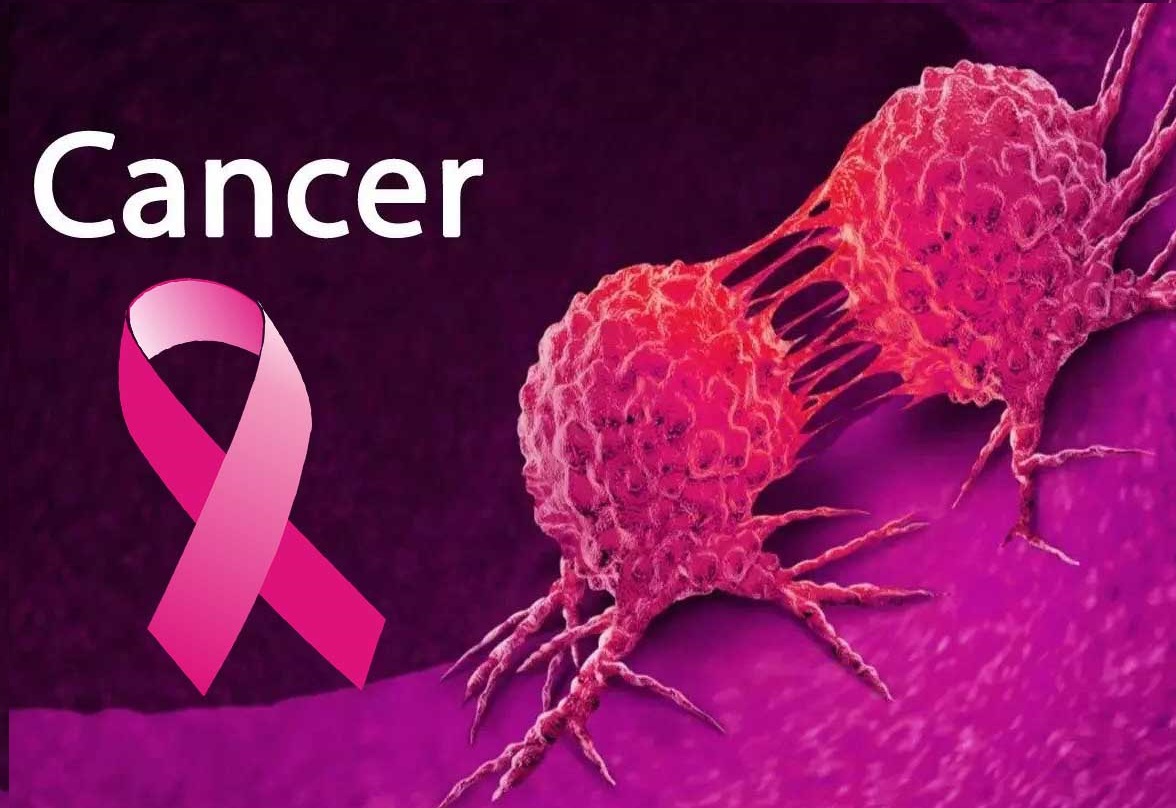 Mom and Cancer